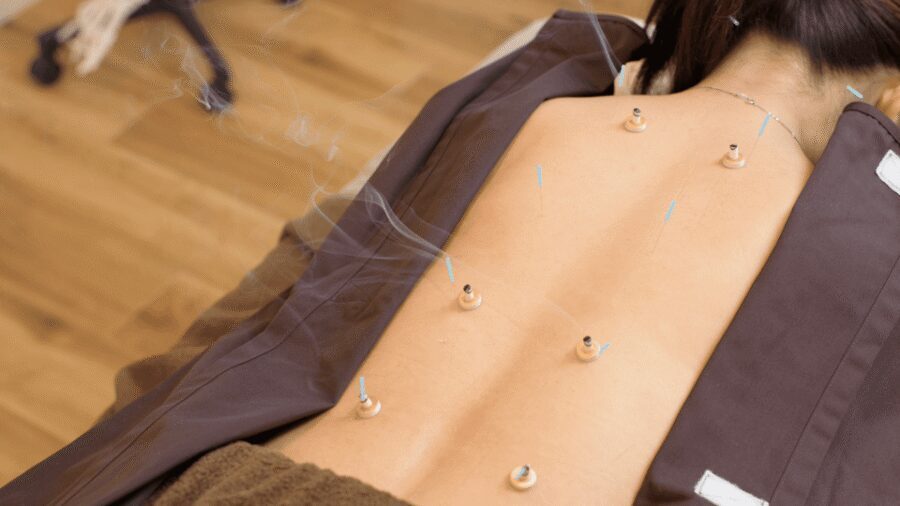 Hiroshima: Acupuncture and Japanese unique massage treatment - Who this is best for (and who should think twice)
