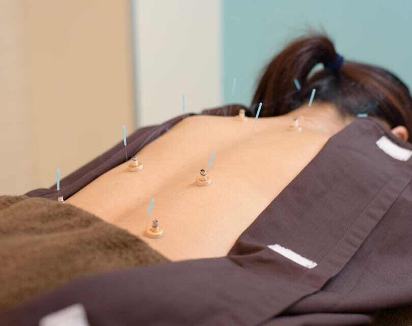 Hiroshima: Acupuncture and Japanese unique massage treatment - Before you go: small prep that makes the session work better